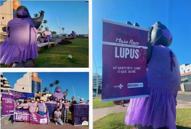 Ireuda defende maior cuidado e qualidade de vida para pessoas com lúpus